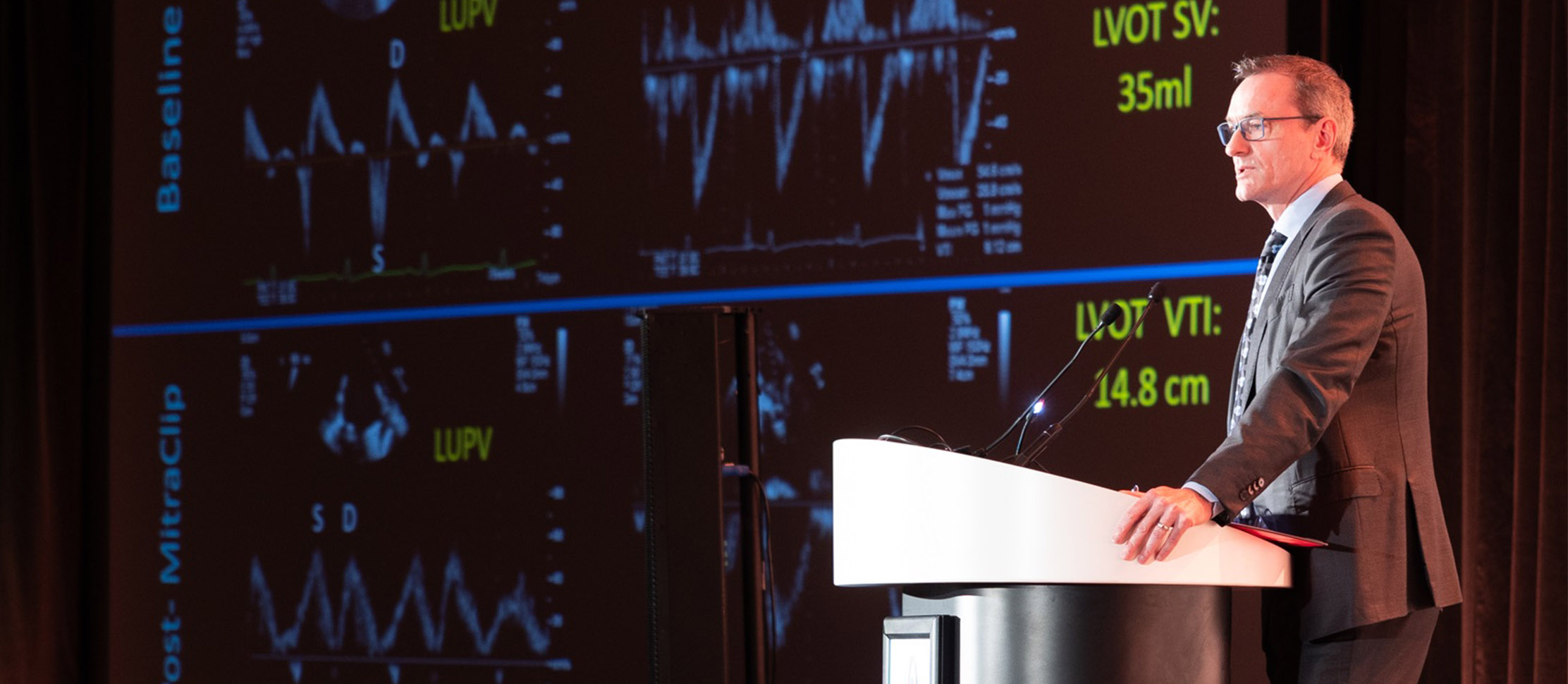 Doctor giving a lecture on echocardiography